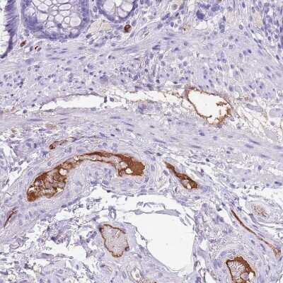 Immunohistochemistry-Paraffin: IGF-I/IGF-1 Antibody [NBP2-48922]