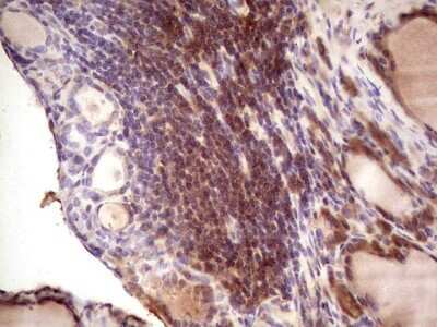 Immunohistochemistry: IGF-I/IGF-1 Antibody (OTI4B12) - Azide and BSA Free [NBP2-71010]