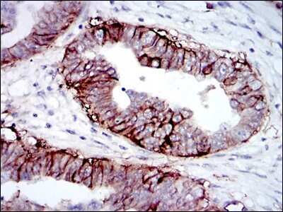 Immunohistochemistry-Paraffin: IGF-I R/IGF1R Antibody (3G5C1) - BSA Free [NB110-87052]