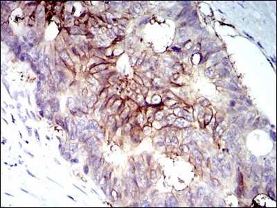 Immunohistochemistry-Paraffin: IGF-I R/IGF1R Antibody (3G5C1) - BSA Free [NB110-87052]