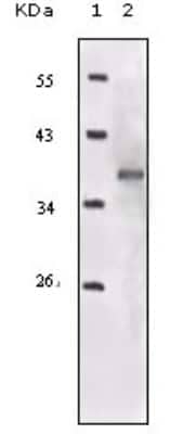 Western Blot: IGF-I R/IGF1R Antibody (3G5C1)BSA Free [NB110-87052]