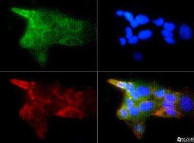 Immunocytochemistry/ Immunofluorescence: IGF-I R/IGF1R Antibody - BSA Free [NBP1-77679]