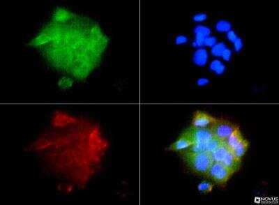 Immunocytochemistry/ Immunofluorescence: IGF-I R/IGF1R Antibody - BSA Free [NBP1-77680]