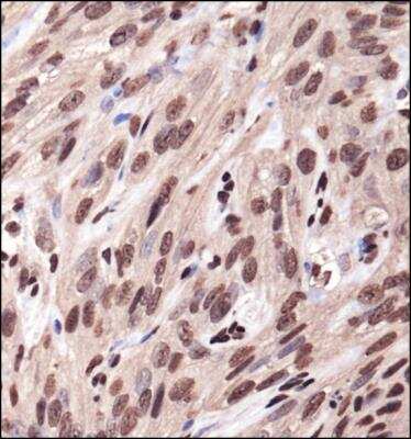Immunohistochemistry-Paraffin: IGF-I R/IGF1R Antibody - BSA Free [NBP1-77679]