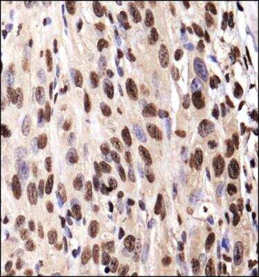 Immunohistochemistry-Paraffin: IGF-I R/IGF1R Antibody - BSA Free [NBP1-77680]