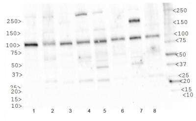 Western Blot: IGF-I R/IGF1R AntibodyBSA Free [NBP1-77679]