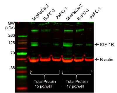Western Blot: IGF-I R/IGF1R AntibodyBSA Free [NBP1-77680]