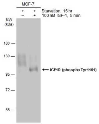 Western Blot: IGF-I R/IGF1R [p Tyr1146] Antibody [NBP3-13236]