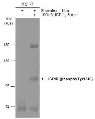 Western Blot: IGF-I R/IGF1R [p Tyr1316] Antibody [NBP3-13234]