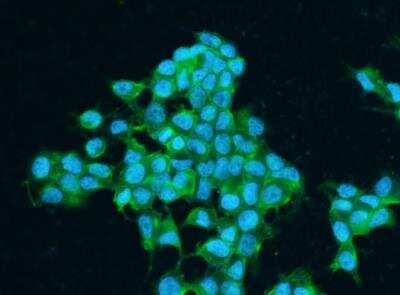 Immunocytochemistry/ Immunofluorescence: IGF-I R/IGF1R Antibody (012) [NBP2-89306]