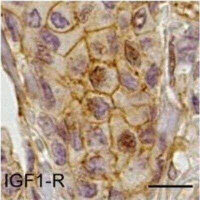 Immunohistochemistry: IGF-I R/IGF1R Antibody (3G5C1) - BSA Free [NB110-87052]