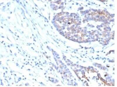 Immunohistochemistry-Paraffin: IGF-I R/IGF1R Antibody (IGF1R/4667) [NBP3-13948]