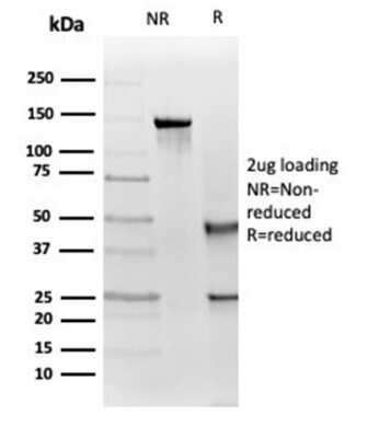 Immunohistochemistry-Paraffin: IGF-I R/IGF1R Antibody (IGF1R/4667) [NBP3-13948]