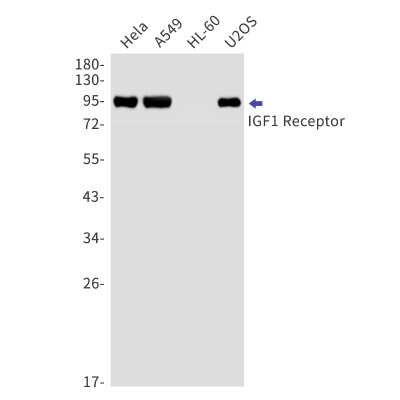 Western Blot: IGF-I R/IGF1R Antibody (S07-7E1) [NBP3-14897]