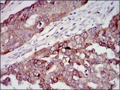 Immunohistochemistry-Paraffin: IGF-II/IGF2 Antibody (8H1) - BSA Free [NBP2-37462]