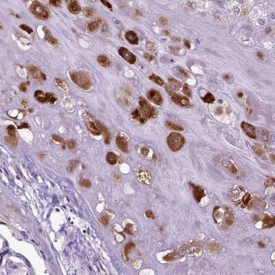 Immunohistochemistry-Paraffin: IGF-II/IGF2 Antibody [NBP2-48510]
