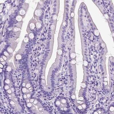 Immunohistochemistry-Paraffin: IGF-II/IGF2 Antibody [NBP2-48510]