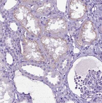 Immunohistochemistry-Paraffin: IGF-II/IGF2 Antibody [NBP2-48510]