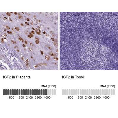 Immunohistochemistry-Paraffin: IGF-II/IGF2 Antibody [NBP2-48510]