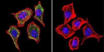 Immunocytochemistry/ Immunofluorescence: IGF-II R/IGF2R Antibody (2G11) - Azide and BSA Free [NBP2-80785]