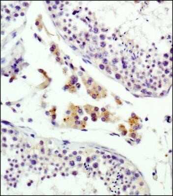 Immunohistochemistry: IGF-II R/IGF2R Antibody (2G11) - Azide and BSA Free [NBP2-80785]