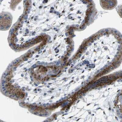 Immunohistochemistry-Paraffin: IGF-II R/IGF2R Antibody [NBP1-84598]