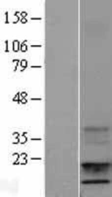 Western Blot: IGF-I/IGF-1 Overexpression Lysate [NBL1-11866]