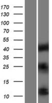 Western Blot: IGF-I/IGF-1 Overexpression Lysate [NBP2-09381]