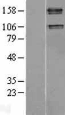 Western Blot: IGF-I R/IGF1R Overexpression Lysate [NBL1-11867]