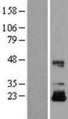 Western Blot: IGF-II/IGF2 Overexpression Lysate [NBL1-11868]