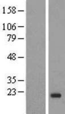 Western Blot: IGF-II/IGF2 Overexpression Lysate [NBL1-11869]