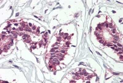 Immunohistochemistry-Paraffin: IGF2BP1 Antibody [NBP1-52044]