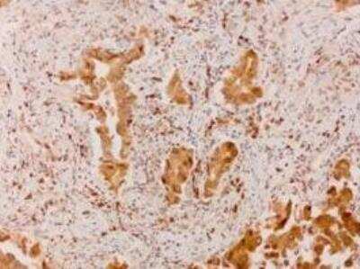 Immunohistochemistry-Paraffin: IGF2BP1 Antibody [NBP1-57495]
