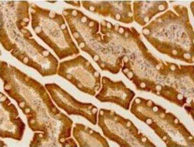 Immunohistochemistry-Paraffin: IGF2BP1 Antibody [NBP1-57495]