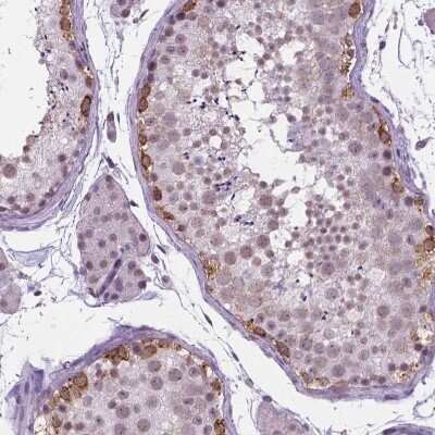 Immunohistochemistry-Paraffin: IGF2BP1 Antibody [NBP1-83108]