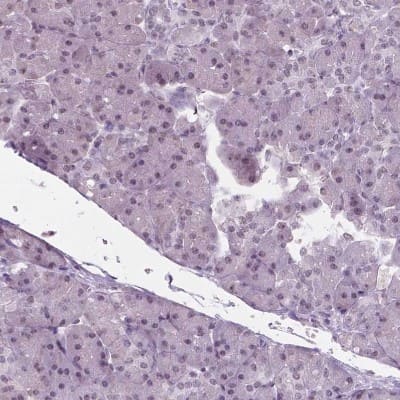 Immunohistochemistry-Paraffin: IGF2BP1 Antibody [NBP1-83108]