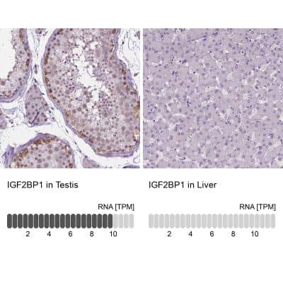 Immunohistochemistry-Paraffin: IGF2BP1 Antibody [NBP1-83108]