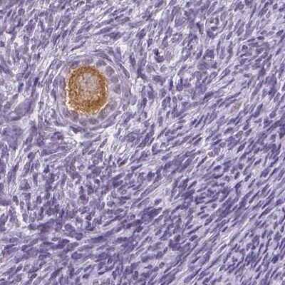 Immunohistochemistry-Paraffin: IGF2BP1 Antibody [NBP1-83108]