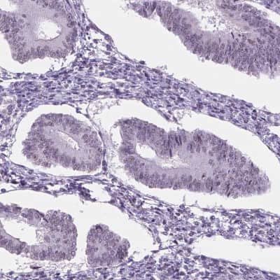 Immunohistochemistry-Paraffin: IGF2BP1 Antibody [NBP1-83108]