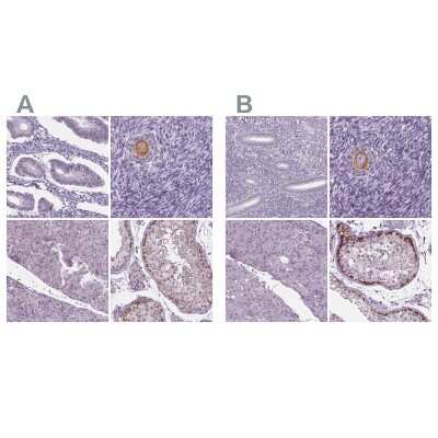 Immunohistochemistry-Paraffin: IGF2BP1 Antibody [NBP1-83108]