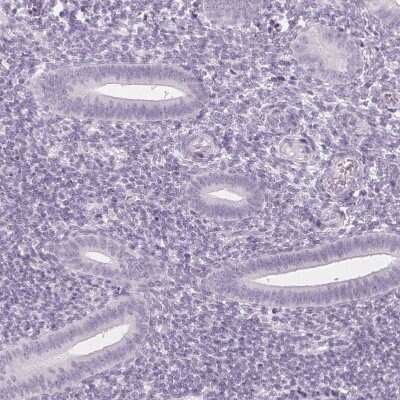 Immunohistochemistry-Paraffin: IGF2BP1 Antibody [NBP2-38956]