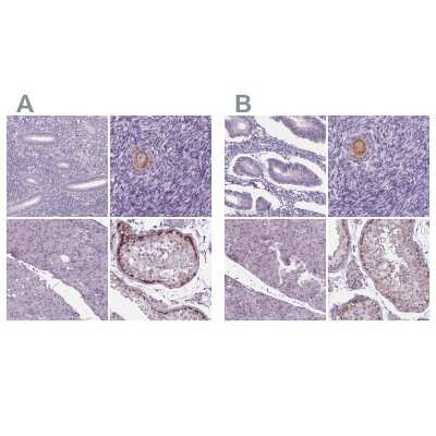 Immunohistochemistry-Paraffin: IGF2BP1 Antibody [NBP2-38956]
