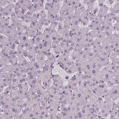Immunohistochemistry-Paraffin: IGF2BP1 Antibody [NBP2-38956]