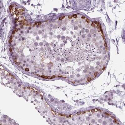 Immunohistochemistry-Paraffin: IGF2BP1 Antibody [NBP2-38956]