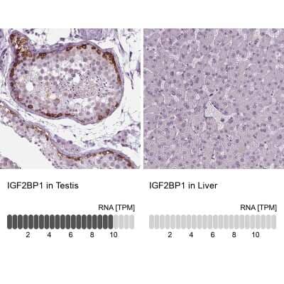 Immunohistochemistry-Paraffin: IGF2BP1 Antibody [NBP2-38956]