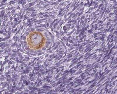 Immunohistochemistry-Paraffin: IGF2BP1 Antibody [NBP2-38956]