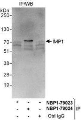 Immunoprecipitation: IGF2BP1 Antibody [NBP1-79024]