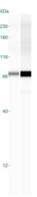Simple Western: IGF2BP1 Antibody [NBP2-38956]