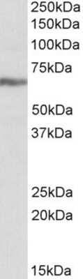 Western Blot: IGF2BP1 Antibody [NBP1-52044]