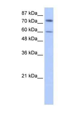 Western Blot: IGF2BP1 Antibody [NBP1-57495]